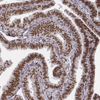 Immunohistochemical staining of human Fallopian tube shows strong nuclear positivity in glandular cells.