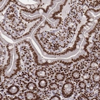 Immunohistochemical staining of human small intestine shows strong nuclear positivity in glandular cells.