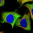 Immunofluorescent staining of human cell line U-2 OS shows localization to cytosol.