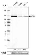 Western blot analysis in RT-4 cells transfected with control siRNA, target specific siRNA probe #1 and #2, using Anti-PARP1 antibody. Remaining relative intensity is presented. Loading control: Anti-GAPDH.
