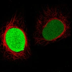 Immunofluorescence staining in HeLa cell line with Anti-PARP1 monoclonal antibody, showing cell cycle dependent nuclear staining in green. Microtubule- and nuclear probes are visualized in red and blue respectively (where available).
