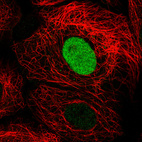 Immunofluorescence staining in A431 cell line with Anti-PARP1 monoclonal antibody, showing cell cycle dependent nuclear staining in green. Microtubule- and nuclear probes are visualized in red and blue respectively (where available).