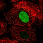 Immunofluorescence staining in A431 cell line with Anti-PARP1 monoclonal antibody, showing cell cycle dependent nuclear staining in green. Microtubule- and nuclear probes are visualized in red and blue respectively (where available).