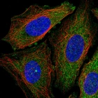 Immunofluorescent staining of human cell line SiHa shows localization to cytosol.