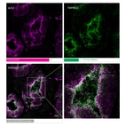 MolBoolean analysis of the interaction between ACE2 (cat. AMAb91259, magenta) and TMPRSS2 (cat. HPA035787, green) in human kidney, showing the relative quantification of free versus interacting protein fractions, indicated by the detection of rolling circle products (RCPs) in either one or two fluorescent channels. Data is normalized to total target protein levels (total RCPs).