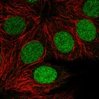 Immunofluorescence staining in MCF7 cell line with Anti-PARP1 monoclonal antibody, showing clear cycle dependent nuclear staining in green. Microtubule- and nuclear probes are visualized in red and blue respectively (where available).