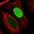 Immunofluorescence staining in U2OS cell line with Anti-PARP1 monoclonal antibody, showing cell cycle dependent nuclear staining in green. Microtubule- and nuclear probes are visualized in red and blue respectively (where available).