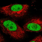 Immunofluorescence staining in U251 cell line with Anti-PARP1 monoclonal antibody, showing cell cycle dependent nuclear staining in green. Microtubule- and nuclear probes are visualized in red and blue respectively (where available).