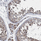 Immunohistochemical staining of human testis shows strong cytoplasmic granular positivity in seminiferous ducts.