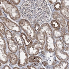 Immunohistochemical staining of human kidney shows strong cytoplasmic granular positivity in cells in tubules.