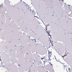 Immunohistochemical staining of human skeletal muscle shows no positivity in myocytes as expected.