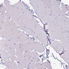 Immunohistochemical staining of human skeletal muscle shows no positivity in myocytes as expected.