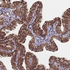 Immunohistochemical staining of human fallopian tube shows strong nuclear and cytoplasmic positivity in glandular cells.