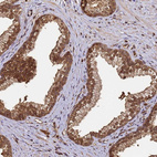 Immunohistochemical staining of human prostate shows strong nuclear and cytoplasmic positivity in glandular cells.