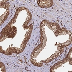 Immunohistochemical staining of human prostate shows strong nuclear and cytoplasmic positivity in glandular cells.