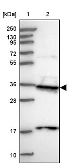 Lane 1: Marker [kDa] 250, 130, 95, 72, 55, 36, 28, 17, 10_br/_Lane 2: Human cell line RT-4