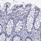 Immunohistochemical staining of human colon shows no positivity in glandular cells as expected.