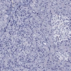 Immunohistochemical staining of human pancreas shows no positivity in exocrine glandular cells as expected.