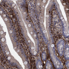 Immunohistochemical staining of human upper small intestine shows moderate cytoplasmic positivity in glandular cells and goblet cells.