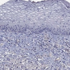 Immunohistochemical staining of human skin shows no positivity in squamous epithelial cells as expected.