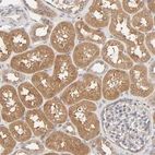 Immunohistochemical staining of human kidney shows moderate cytoplasmic positivity in cells in tubules.