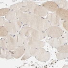 Immunohistochemical staining of human skeletal muscle shows very weak cytoplasmic positivity in myocytes as expected.