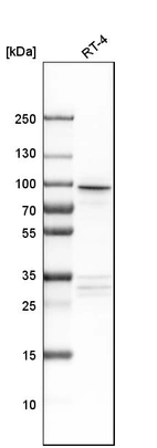 Western blot analysis in human cell line RT-4.
