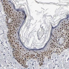 Immunohistochemical staining of human skin shows strong nuclear positivity in squamous epithelial cells.