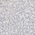 Immunohistochemical staining of human liver shows no positivity as expected.