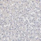 Anti-GRHL2 Antibody