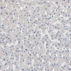 Immunohistochemical staining of human liver shows no positivity as expected.