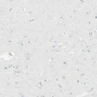 Immunohistochemical staining of human cerebral cortex shows no positivity in neurons as expected.