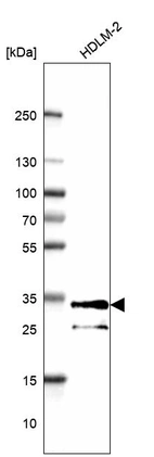 Western blot analysis in human cell line HDLM-2.