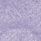 Immunohistochemical staining of human tonsil shows no positivity in non-germinal center cells as expected.