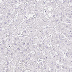 Anti-GP2 Antibody