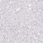 Immunohistochemical staining of human liver shows no positivity in hepatocytes as expected.