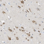 Immunohistochemical staining of human cerebral cortex shows moderate cytoplasmic positivity in neurons.