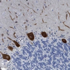 Immunohistochemical staining of human cerebellum shows strong cytoplasmic positivity in Purkinje cells.