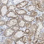 Immunohistochemical staining of human kidney shows moderate cytoplasmic-membranous positivity in cells in tubules.