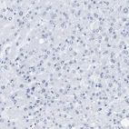 Immunohistochemical staining of human liver shows no positivity in hepatocytes.