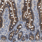 Immunohistochemical staining of human duodenum shows strong cytoplasmic/ membranous positivity in glandular cells.