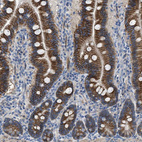 Anti-DHX58 Antibody