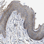 Anti-DHX58 Antibody