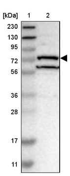 Lane 1: Marker [kDa] 230, 130, 95, 72, 56, 36, 28, 17, 11_br/_Lane 2: Human cell line RT-4