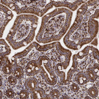 Immunohistochemical staining of human duodenum shows strong granular cytoplasmic positivity in glandular cells.