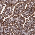 Immunohistochemical staining of human duodenum shows strong granular cytoplasmic positivity in glandular cells.