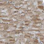 Immunohistochemical staining of human skeletal muscle shows moderate cytoplasmic positivity in myocytes.
