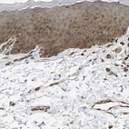Immunohistochemical staining of human skin shows moderate cytoplasmic positivity in squamous epithelial cells.