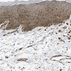 Immunohistochemical staining of human skin shows moderate cytoplasmic positivity in squamous epithelial cells.