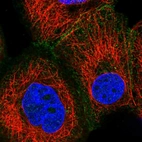 Immunofluorescent staining of human cell line A-431 shows localization to plasma membrane & cell junctions.